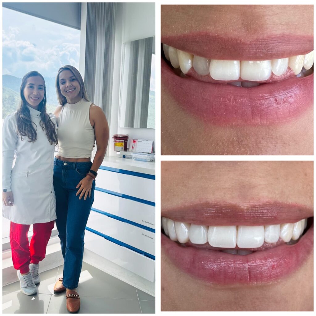 How much does it cost to have your teeth done in Colombia
