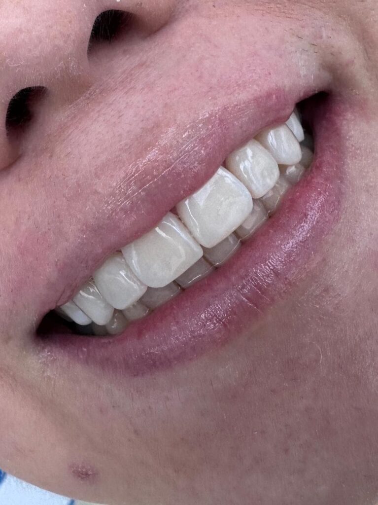How much does a dentist cost in Colombia?