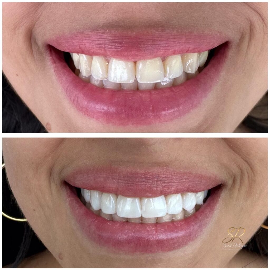 Is Colombia a good place to get dental work?