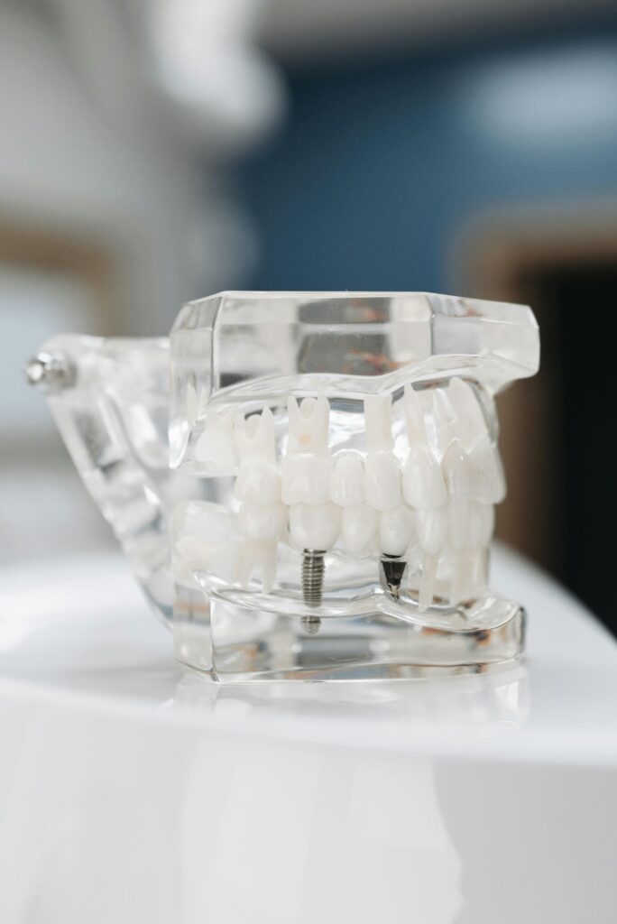 IMPLANTES DENTALES CALI