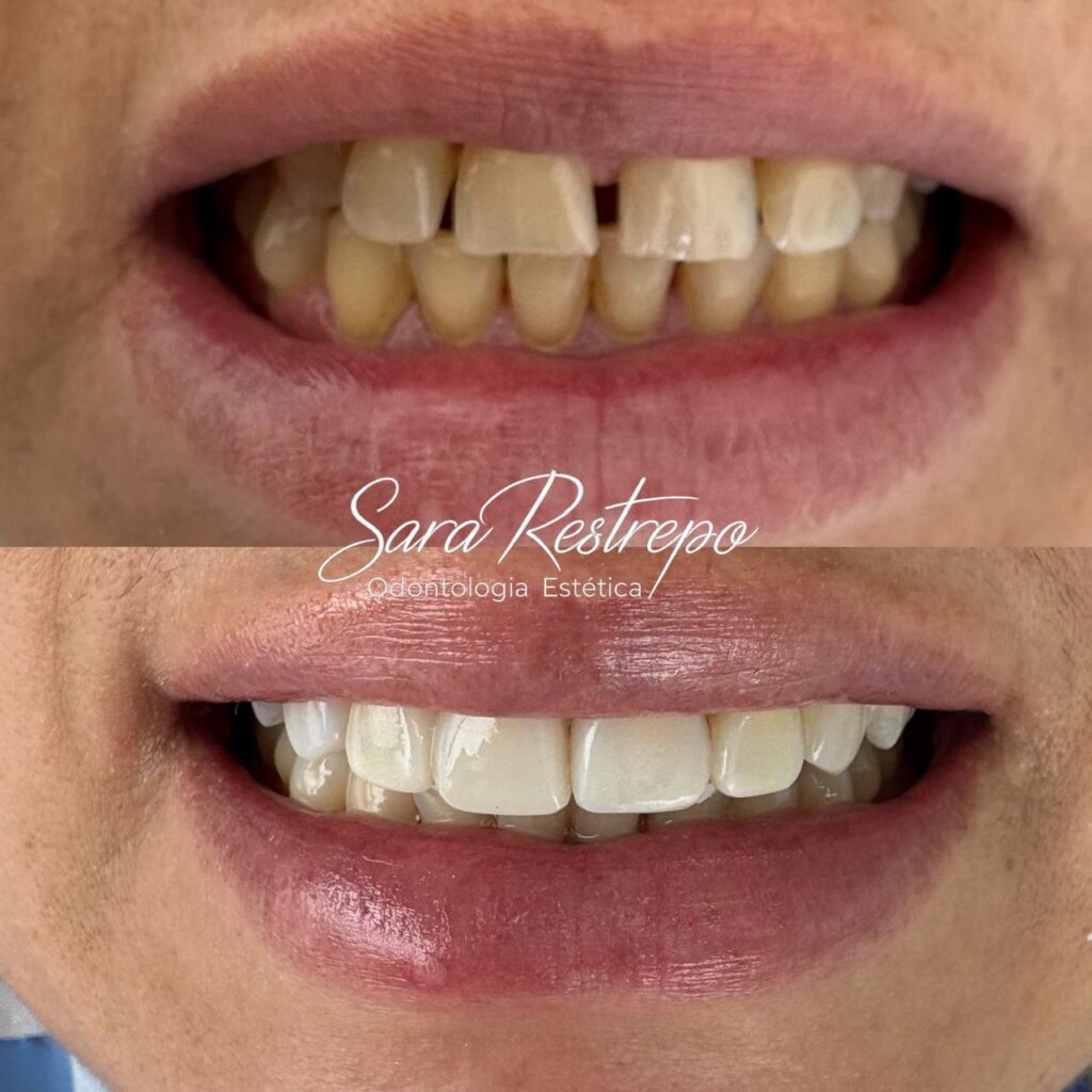 clínica dental cali colombia