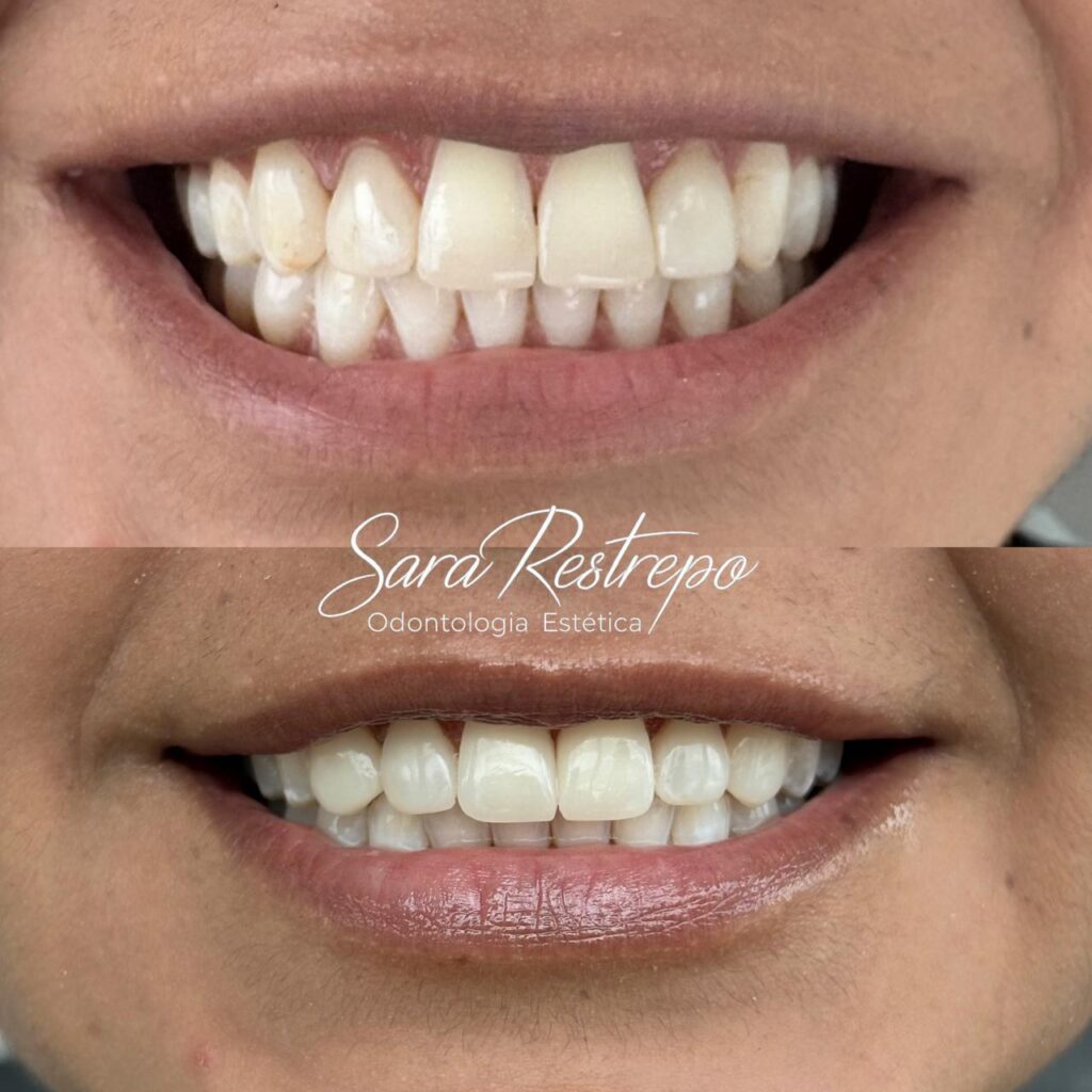 diseño de sonrisa cali instagram