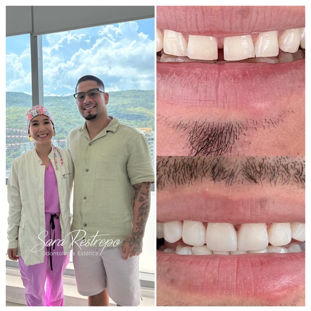 ¿Cuánto cuesta hacerse los dientes en Colombia?