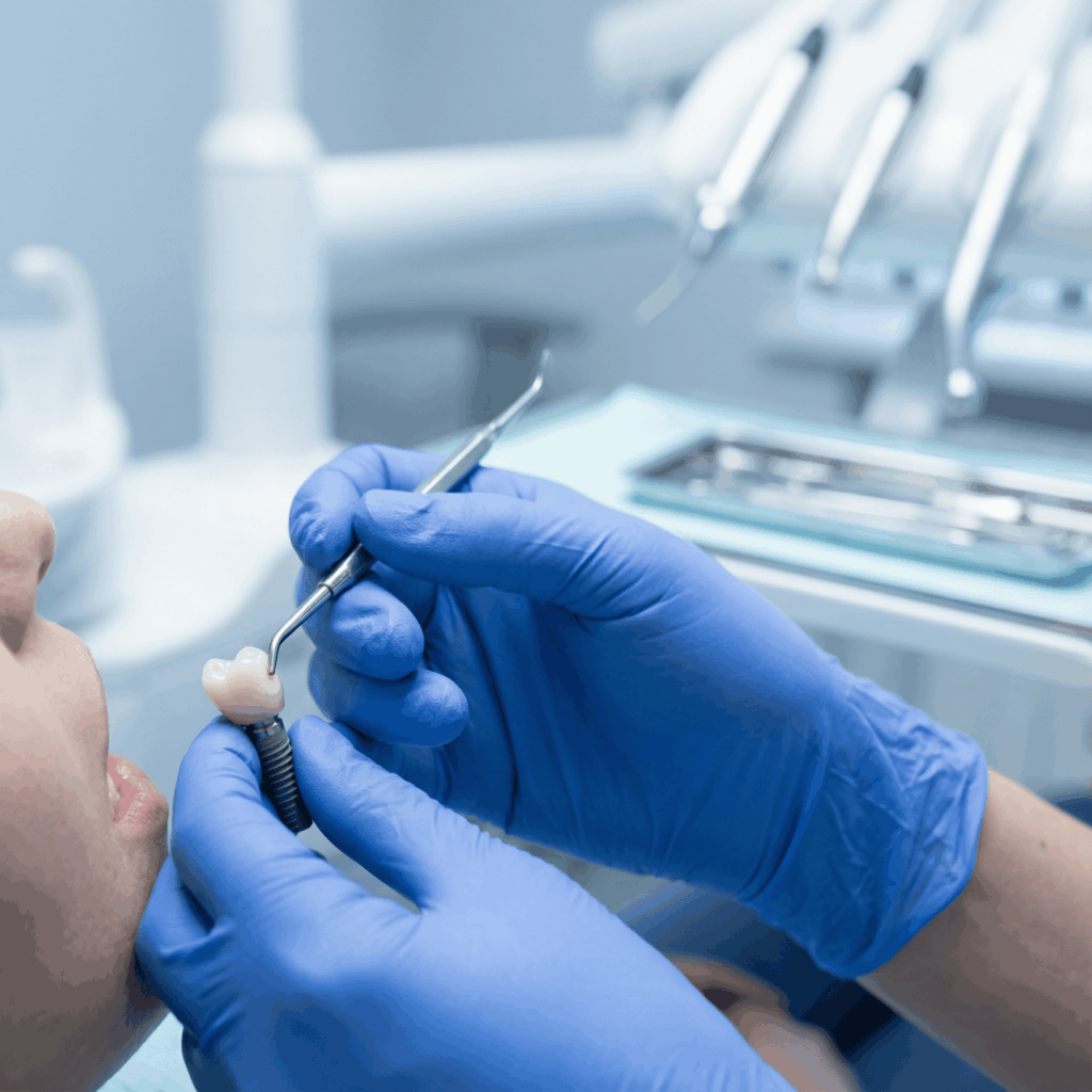 ¿Qué precio aproximado tiene un implante dental?