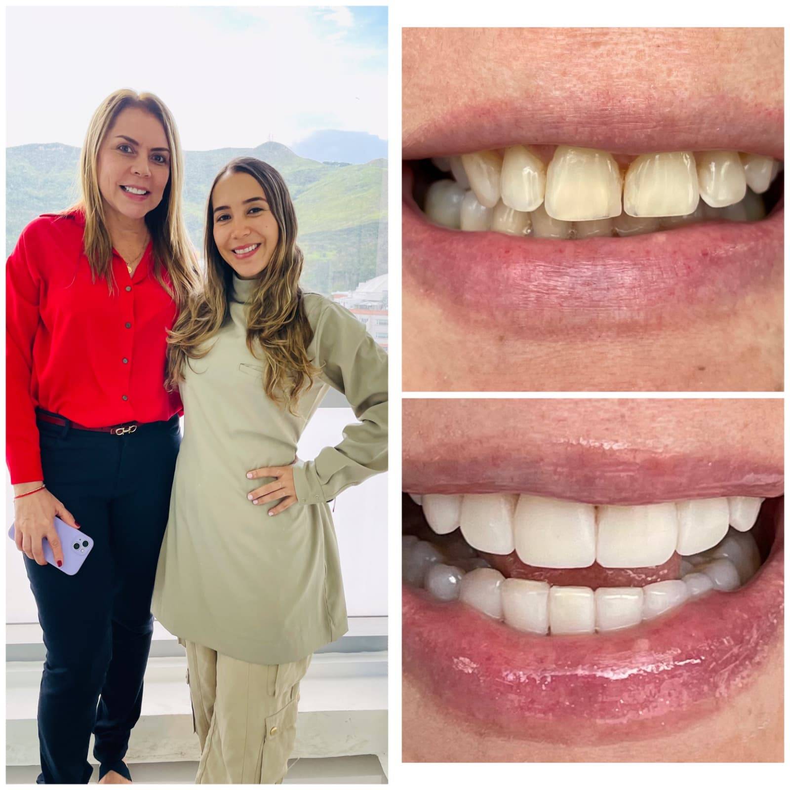 diseño de sonrisa Cali